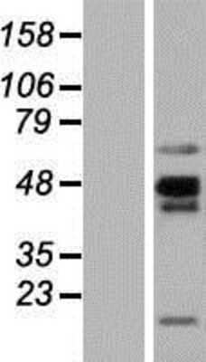 Western Blot: NKAPL Overexpression Lysate (Adult Normal) [NBP2-08816] Left-Empty vector transfected control cell lysate (HEK293 cell lysate); Right -Over-expression Lysate for NKAPL.
