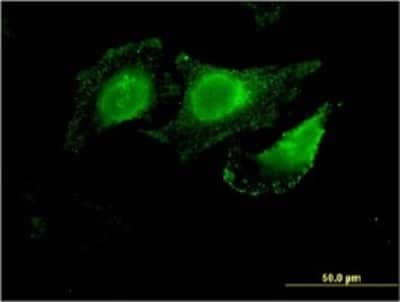 Immunocytochemistry/Immunofluorescence: NKCC1/SLC12A2 Antibody (5H7) [H00006558-M01] - Analysis of monoclonal antibody to SLC12A2 on HeLa cell . Antibody concentration 10 ug/ml.