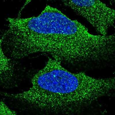 Immunocytochemistry/Immunofluorescence: NKCC1/SLC12A2 Antibody [NBP2-56180] - Staining of human cell line U-2 OS shows localization to plasma membrane & vesicles. Antibody staining is shown in green. 