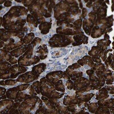 Immunohistochemistry-Paraffin: NKCC1/SLC12A2 Antibody [NBP1-89928] - Staining of human pancreas shows strong cytoplasmic positivity in exocrine cells.