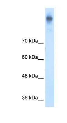 Western Blot: NKCC1/SLC12A2 Antibody [NBP1-59430] - Titration: 5.0ug/ml, Positive Control: DLD1 cell lysate.