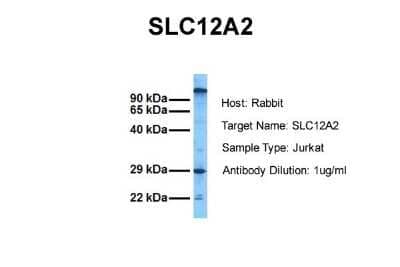 Western Blot: NKCC1/SLC12A2 Antibody [NBP1-59430] - Sample Tissue: Human Jurkat Antibody Dilution: 1.0 ug/ml