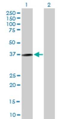 Western Blot: NKG2A/CD159a/KLRC1 Antibody [H00003821-B01P] - Analysis of KLRC1 expression in transfected 293T cell line by KLRC1 polyclonal antibody.  Lane 1: KLRC1 transfected lysate(26.30 KDa). Lane 2: Non-transfected lysate.