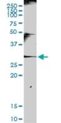 Western Blot: NKG2A/CD159a/KLRC1 Antibody [H00003821-D01P] - Analysis of KLRC1 expression in human spleen.