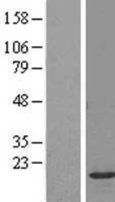 Western Blot NKG7 Overexpression Lysate