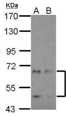 Western Blot: NKIAMRE Antibody [NBP2-19544] - Sample (30 ug of whole cell lysate) A: NT2D1 B: IMR32 7. 5% SDS PAGE gel, diluted at 1:2000.