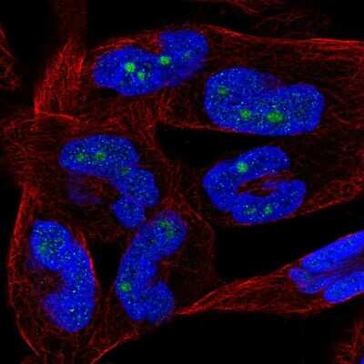 Immunocytochemistry/Immunofluorescence: NKIRAS2 Antibody [NBP2-56207] - Staining of human cell line RH-30 shows localization to nucleus & nucleoli.