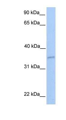 Western Blot: NKIRAS2 Antibody [NBP1-58925] - 721_B cell lysate, concentration 0.2-1 ug/ml.