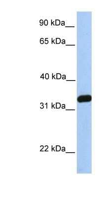Western Blot: NKIRAS2 Antibody [NBP1-58926] - 721_B cell lysate, concentration 0.2-1 ug/ml.