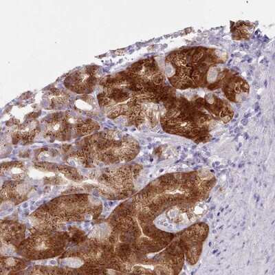 Immunohistochemistry-Paraffin: NKX1-2 Antibody [NBP2-14498] - Staining of human stomach, lower shows strong cytoplasmic positivity in glandular cells.