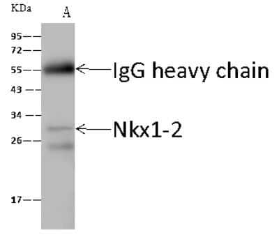 Immunoprecipitation: NKX1-2 Antibody [NBP2-99300] - NKX1-2 was immunoprecipitated using: Lane A: 0.5 mg HeLa Whole Cell Lysate. 4 ul anti-NKX1-2 rabbit polyclonal antibody and 60 ug of Immunomagnetic beads. Protein A/G. Primary antibody: Anti-NKX1-2 rabbit polyclonal antibody, at 1:100 dilution. Secondary antibody: Goat Anti-Rabbit IgG (H+L)/HRP at 1/10000 dilution. Developed using the ECL technique. Performed under reducing conditions. Predicted band size: 18 kDa. Observed band size: 13 kDa.