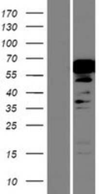 Western Blot: NKX2.3 Overexpression Lysate (Adult Normal) [NBP2-05494] Left-Empty vector transfected control cell lysate (HEK293 cell lysate); Right -Over-expression Lysate for NKX2.3.