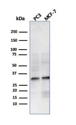Western Blot: NKX2.8 Antibody (NKX28/3233R) - Azide and BSA Free [NBP3-08653] - Western Blot Analysis of PC3 and MCF-7 cell lysate using NKX2.8 Recombinant Rabbit Monoclonal Antibody (NKX28/3233R).
