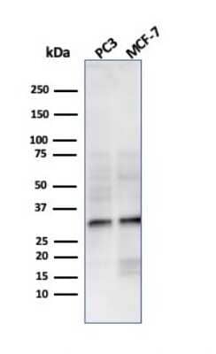 Western Blot: NKX2.8 Antibody (NKX28/3233R) [NBP3-07637] - Western Blot Analysis of PC3 and MCF-7 cell lysate using NKX2.8 Recombinant Rabbit Monoclonal Antibody (NKX28/3233R).