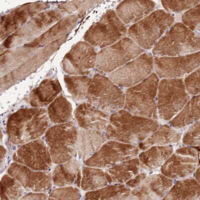 Immunohistochemistry-Paraffin: NKX2.3 Antibody [NBP2-13659] - Staining of human skeletal muscle shows moderate cytoplasmic positivity in myocytes.