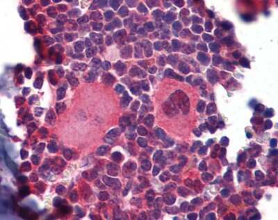 Immunohistochemistry-Paraffin: NKX2.3 Antibody [NBP3-10406] - Immunohistochemical analysis of paraffin-embedded mouse lymphoid tissue (skeletal muscle) tissue. Antibody dilution of 5 ug/ml.