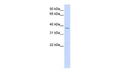 Western Blot: NKX2.3 Antibody [NBP2-85384] - WB Suggested Anti-NKX2-3 Antibody Titration: 0.2-1 ug/ml. ELISA Titer: 1:312500. Positive Control: HepG2 cell lysate