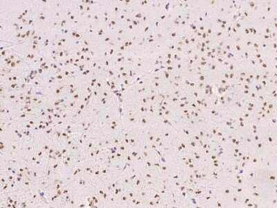 Immunohistochemistry-Paraffin: NKX2.5 Antibody [NBP2-99133] - Immunochemical staining of mouse NKX2.5 in mouse brain with rabbit polyclonal antibody at 1:5000 dilution, formalin-fixed paraffin embedded sections.