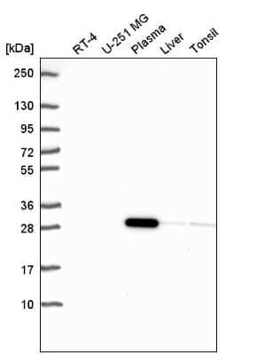 Western Blot: NKX2.5 Antibody [NBP2-57744] - Western blot analysis in human cell line RT-4, human cell line U-251 MG, human plasma, human liver tissue and human tonsil tissue.