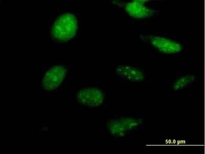 Immunocytochemistry/Immunofluorescence: NKX2.8 Antibody [H00026257-B01P] - Analysis of purified antibody to NKX2-8 on HeLa cell. (antibody concentration 10 ug/ml)