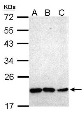 Western Blot: NKX2.8 Antibody [NBP1-31642] - Sample (30 ug of whole cell lysate) A: Hep G2 B: Molt-4 C: Raji 12% SDS PAGE; antibody diluted at 1:1000.