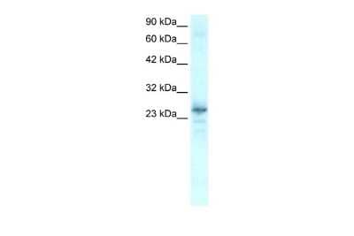 Western Blot: NKX2.8 Antibody [NBP2-87923] - WB Suggested Anti-NKX2-8 Antibody Titration: 0.2-1 ug/ml. ELISA Titer: 1:62500. Positive Control: Human heart