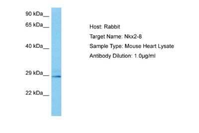 Western Blot: NKX2.8 Antibody [NBP2-87923] - Host: Mouse. Target Name: NKX2-8. Sample Tissue: Mouse Heart. Antibody Dilution: 1ug/ml