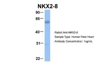 Western Blot: NKX2.8 Antibody [NBP2-87923] - Host: Rabbit. Target Name: NKX2-8. Sample Type: Human Fetal Heart. Antibody Dilution: 1.0ug/ml