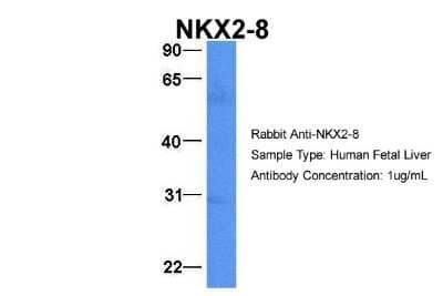 Western Blot: NKX2.8 Antibody [NBP2-87923] - Host: Rabbit. Target Name: NKX2-8. Sample Type: Human Fetal Liver. Antibody Dilution: 1.0ug/ml