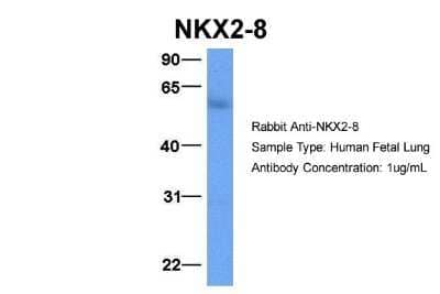 Western Blot: NKX2.8 Antibody [NBP2-87923] - Host: Rabbit. Target Name: NKX2-8. Sample Type: Human Fetal Lung. Antibody Dilution: 1.0ug/ml