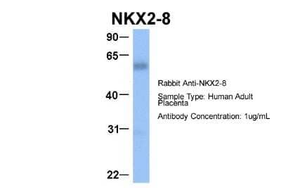 Western Blot: NKX2.8 Antibody [NBP2-87923] - Host: Rabbit. Target Name: NKX2-8. Sample Type: Human Adult Placenta. Antibody Dilution: 1.0ug/ml
