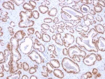 Immunohistochemistry-Paraffin: NKX3.1 Antibody (NKX3.1/2836) [NBP3-07435] - Formalin-fixed, paraffin-embedded human prostate stained with NKX3.1-Monospecific Mouse Monoclonal Antibody (NKX3.1/2836).