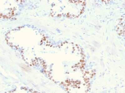 Immunohistochemistry-Paraffin: NKX3.1 Antibody (NKX3.1/2836) [NBP3-08677] - Formalin-fixed, paraffin-embedded human prostate stained with NKX3.1-Monospecific Mouse Monoclonal Antibody (NKX3.1/2836).