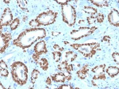 Immunohistochemistry-Paraffin: NKX3.1 Antibody (NKX3.1/4562R) - Azide and BSA Free [NBP3-08744] - Formalin-fixed, paraffin-embedded human prostate stained with NKX3.1 Recombinant Rabbit Monoclonal Antibody (NKX3.1/4562R).