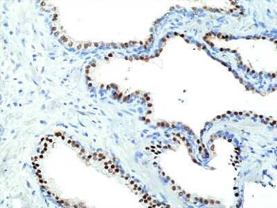 Immunohistochemistry-Paraffin: NKX3.1 Antibody (RM430) [NBP3-09180] - Immunohistochemical staining of formalin fixed and paraffin embedded human prostate tissue section using NBP3-09180 at a 1:200 dilution