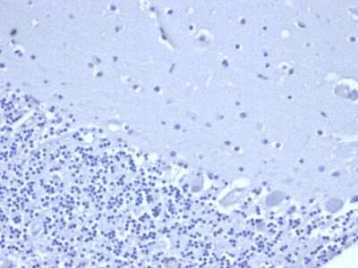 Immunohistochemistry-Paraffin: NKX3.1 Antibody (rNKX3.1/6620) - Azide and BSA Free [NBP3-08573] - IHC analysis of formalin-fixed, paraffin-embedded human brain. Negative tissue control using NKX3.1 antibody (rNKX3.1/6620) at 2ug/ml in PBS for 30min RT. HIER: Tris/EDTA, pH9.0, 45min. 2 : HRP-polymer, 30min. DAB, 5min.