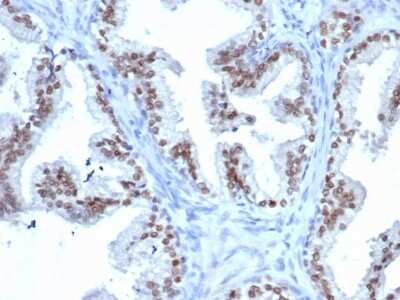 Immunohistochemistry-Paraffin: NKX3.1 Antibody (rNKX3.1/6620) [NBP3-07412] - Formalin-fixed, paraffin-embedded human prostate stained with NKX3.1 Recombinant Mouse Monoclonal Antibody (rNKX3.1/6620).