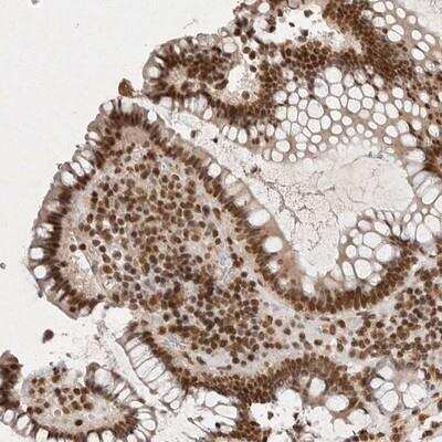 Immunohistochemistry-Paraffin: NKX3-2 Antibody [NBP1-88708] - Staining of human colon shows strong nuclear positivity in glandular cells.