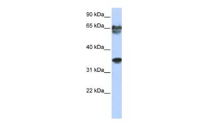 Western Blot: NKX3-2 Antibody [NBP2-87924] - WB Suggested Anti-NKX3-2 Antibody Titration: 0.2-1 ug/ml. ELISA Titer: 1:2500. Positive Control: Jurkat cell lysate