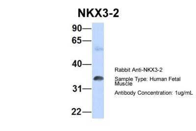 Western Blot: NKX3-2 Antibody [NBP2-87924] - Host: Rabbit. Target Name: NKX3-2. Sample Type: Human Fetal Muscle. Antibody Dilution: 1.0ug/ml