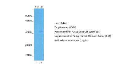 Western Blot: NKX3-2 Antibody [NBP2-87927] - Host: Rabbit. Target: NKX3-2. Positive control (+): 293T (2T). Negative control (-): Stomach tumor (T-ST). Antibody concentration: 1ug/ml