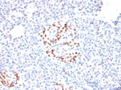 Immunohistochemistry-Paraffin: NKX6.1 Antibody (NKX61/2561) - Azide and BSA Free [NBP2-79872] - Formalin-fixed, paraffin-embedded human pancreas stained with NKX6.1 mouse monoclonal antibody (NKX61/2561).