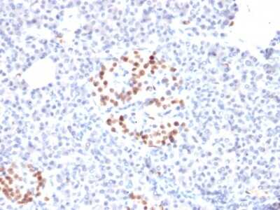 Immunohistochemistry-Paraffin: NKX6.1 Antibody (NKX61/2561) [NBP2-79737] - Formalin-fixed, paraffin-embedded human Pancreas stained with NKX6.1 Antibody (NKX61/2561).