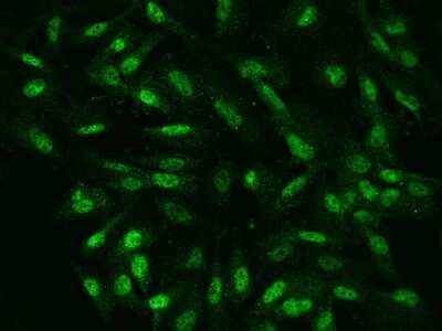 Immunocytochemistry/Immunofluorescence: NKX6.1 Antibody [NBP2-97468] - Immunofluorescence staining of NKX6.1 in U251MG cells. Cells were fixed with 4% PFA, permeabilzed with 0.1% Triton X-100 in PBS, blocked with 10% serum, and incubated with rabbit anti-Human NKX6.1 polyclonal antibody (dilution ratio 1:200) at 4C overnight. Then cells were stained with the Alexa Fluor(R)488-conjugated Goat Anti-rabbit IgG Secondary antibody (green). Positive staining was localized to Nucleus.