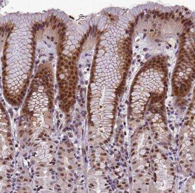 Immunohistochemistry-Paraffin: NKX6.3 Antibody [NBP1-92185] - Staining of human stomach shows moderate nuclear positivity in glandular cells.