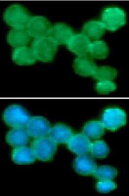 Immunocytochemistry/Immunofluorescence: NKp44/NCR2 Antibody (1G6) [NBP2-42683] - Analysis of NKp44 in Jurkat cells line, stained with DAPI (Blue) for nucleus staining and monoclonal anti-human NKp44 antibody (1:100) with goat anti-mouse IgG-Alexa fluor 488 conjugate (Green).