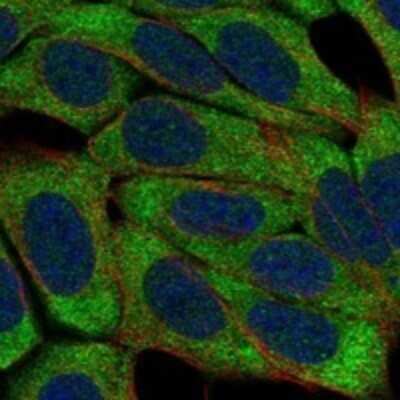 Immunocytochemistry/Immunofluorescence: NKp80/KLRF1 Antibody [NBP3-17283] - Staining of human cell line HAP1 shows localization to plasma membrane.
