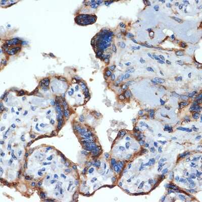 Immunohistochemistry-Paraffin: NLK Antibody (6G5V10) [NBP3-15728] - Human placenta using NLK Rabbit mAb (NBP3-15728) at dilution of 1:100 (40x lens).Perform microwave antigen retrieval with 10 mM Tris/EDTA buffer pH 9.0 before commencing with IHC staining protocol.
