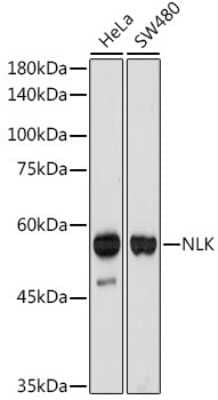 Western Blot: NLK Antibody (6G5V10) [NBP3-15728] - Analysis of extracts of various cell lines, using NLK antibody (NBP3-15728) at 1:1000 dilution. Secondary antibody: HRP Goat Anti-Rabbit IgG (H+L) at 1:10000 dilution. Lysates/proteins: 25ug per lane. Blocking buffer: 3% nonfat dry milk in TBST. Detection: ECL Basic Kit. Exposure time: 180s.