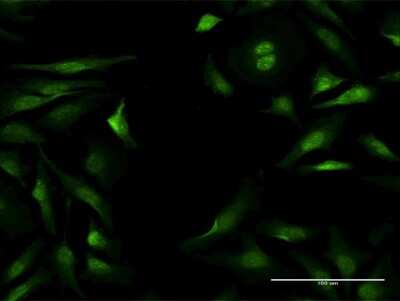 Immunocytochemistry/Immunofluorescence: NLK Antibody [H00051701-B02P] - Analysis of purified antibody to NLK on HeLa cell. (antibody concentration 10 ug/ml)